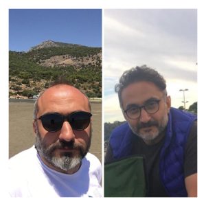 HairXNose hair transplant before and after case image 20