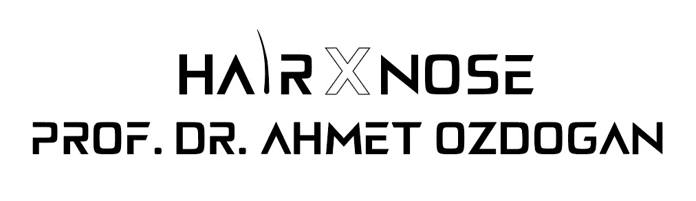 HairXNose hair transplant before and after case image 23