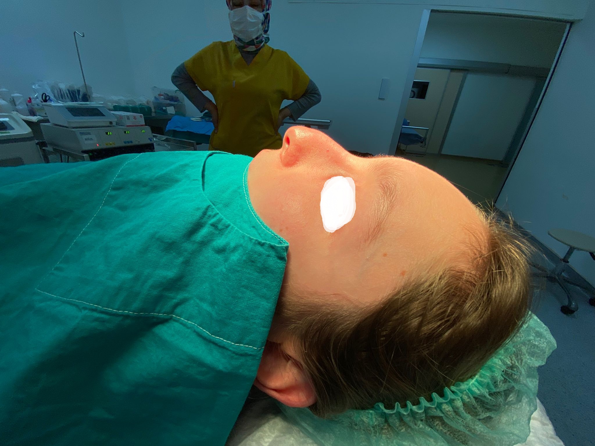 HairXNose rhinoplasty before and after case image 15