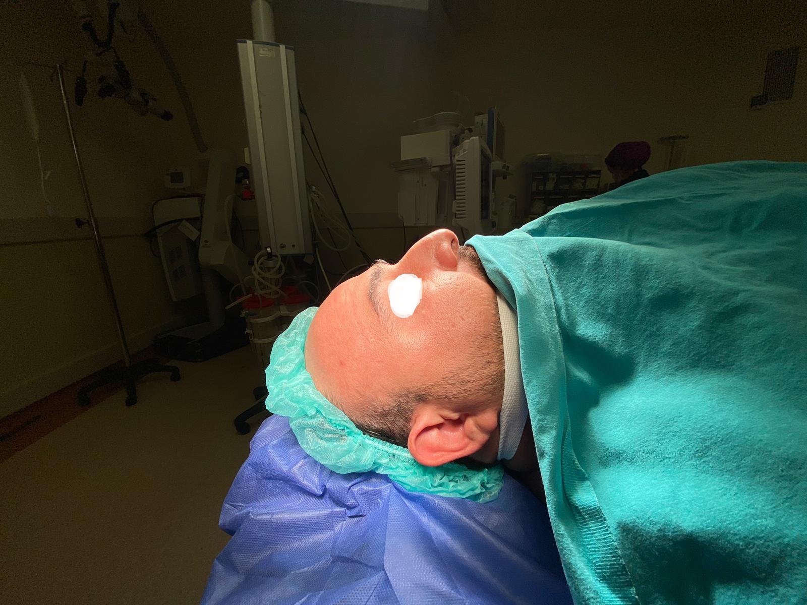 HairXNose rhinoplasty before and after case image 17