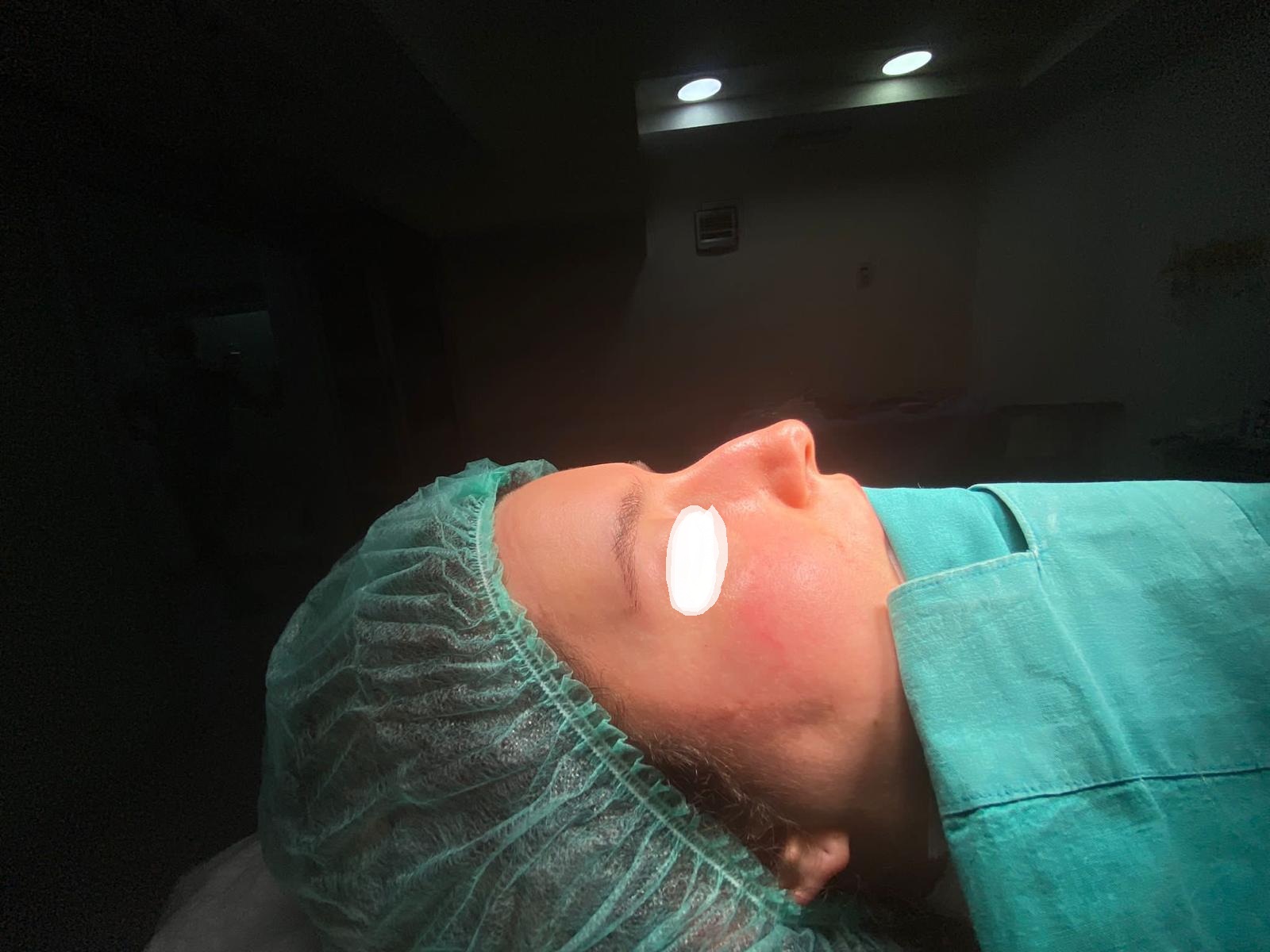 HairXNose rhinoplasty before and after case image 23